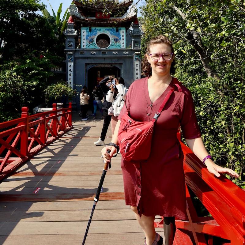 Above-knee amputee with prosthetic leg crosses a bridge in Hanoi, Vietnam